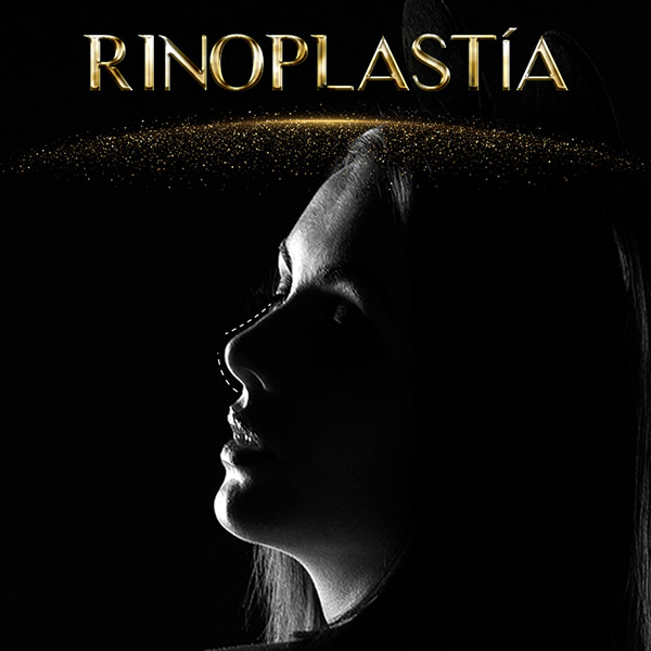Rinoplastía